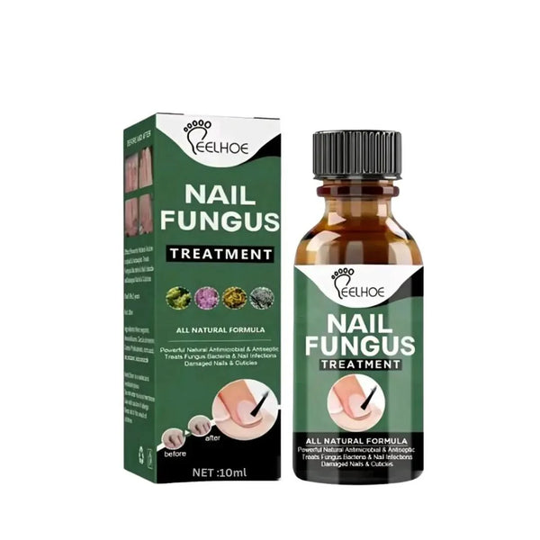 Nail Fungus Treatment Serum 10ml – Fast & Effective Fungal Solution